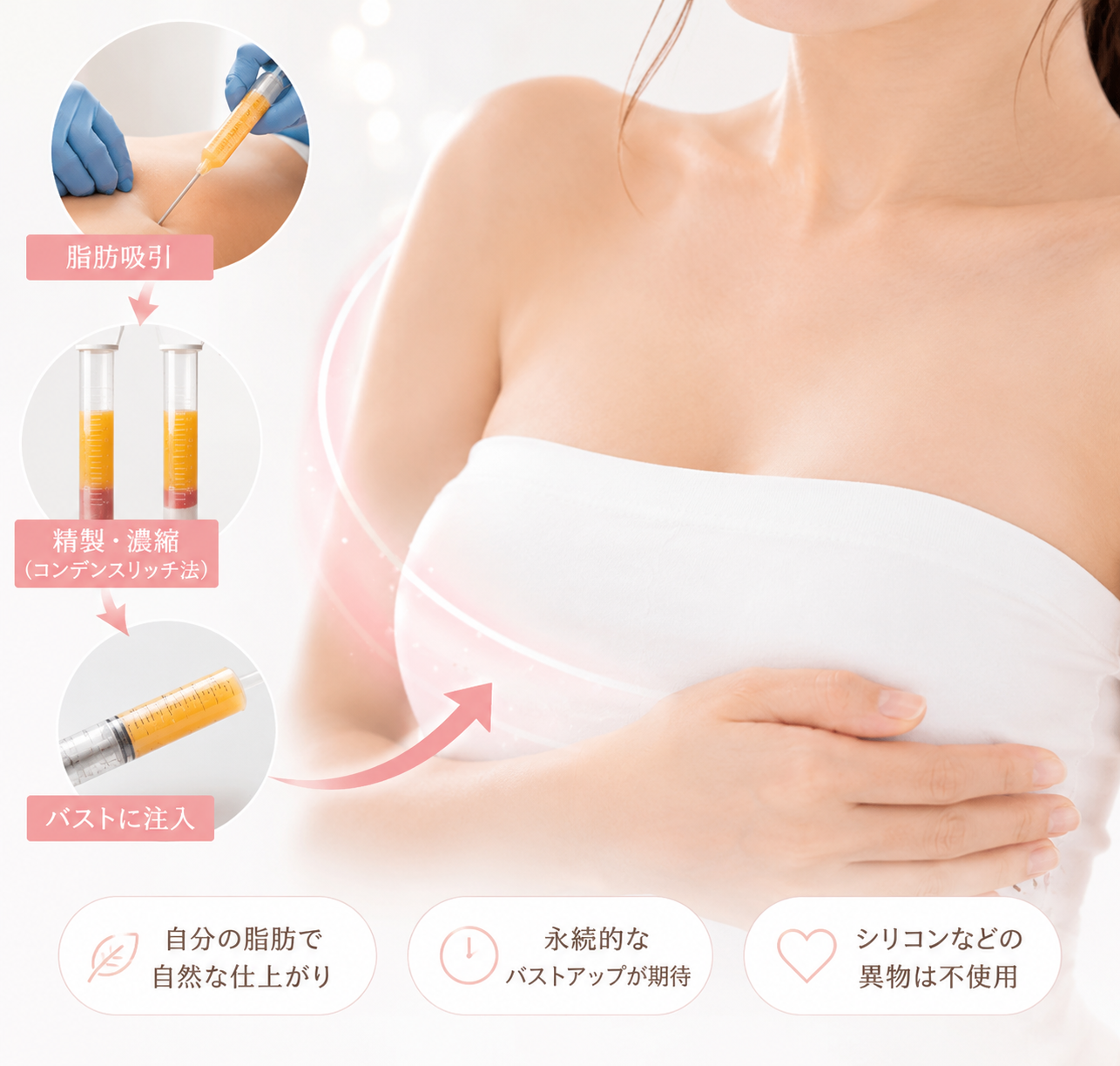 脂肪注入豊胸術