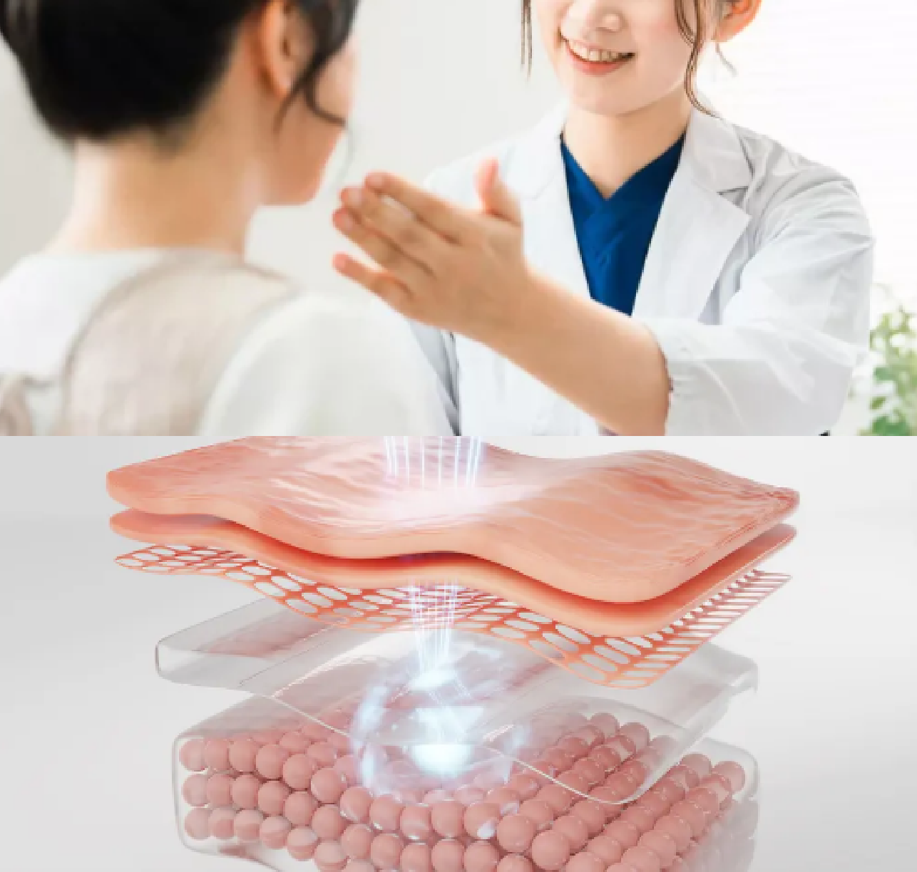 セレクトクリニックのダーマシャインプロ施術イメージ