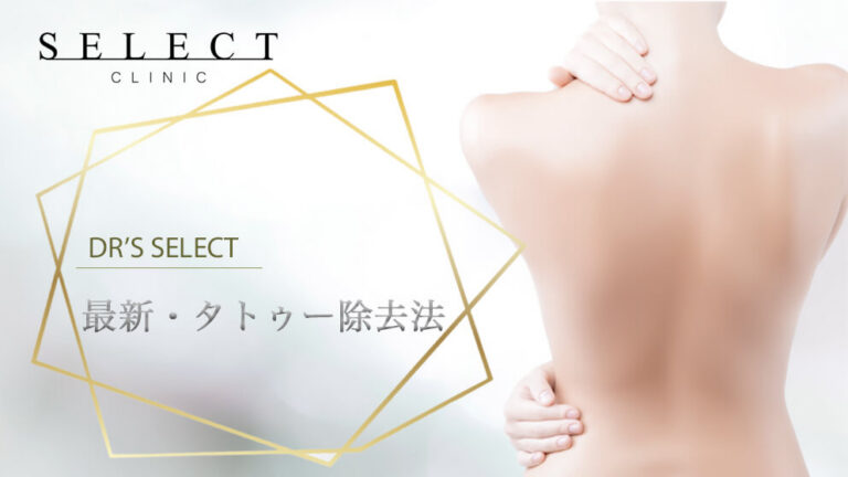 タトゥー（刺青）除去の費用・値段は？タトゥー除去の種類や消す方法を専門医師が解説！