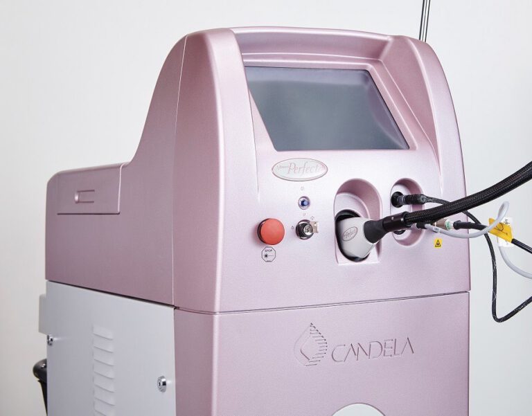 ビフォーアフター有｜Vビーム2 治療の特徴や機能面について解説