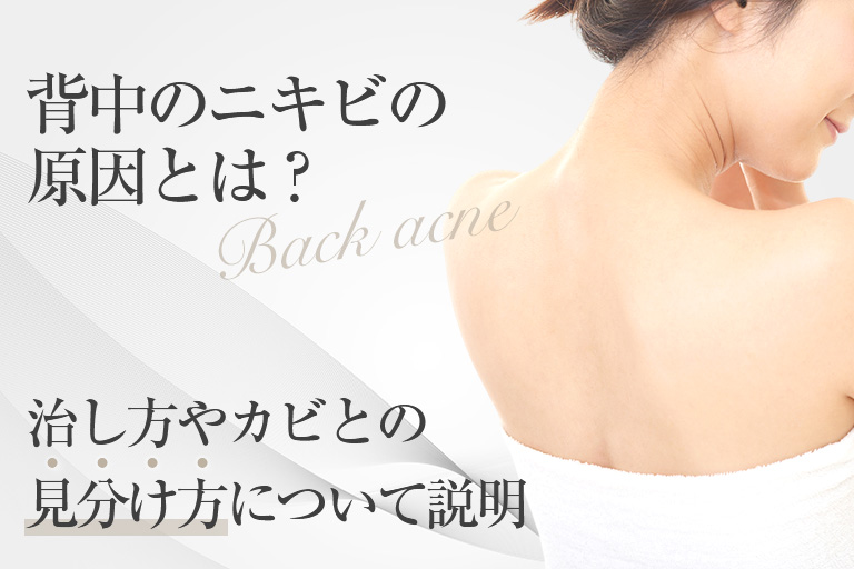 背中ニキビの原因は内臓？治し方やカビとの見分け方について