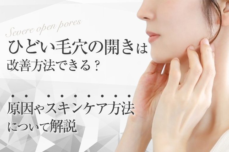 ビフォーアフター有｜ひどい毛穴の開きは改善方法できる？原因やスキンケア方法について解説
