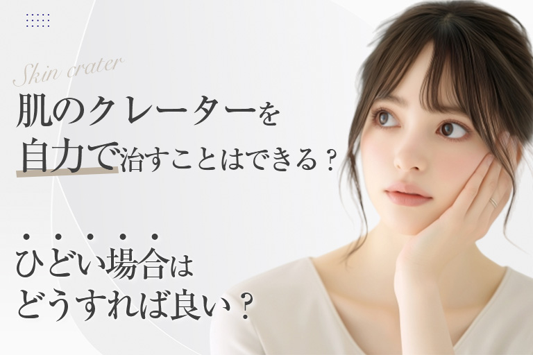 肌のクレーターを自力で治すことはできる？ひどい場合はどうすれば良い？