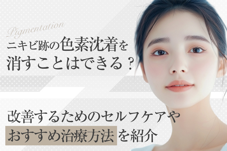 ビフォーアフター有｜ニキビ跡の色素沈着を消すことはできる？改善するためのセルフケアやおすすめ治療方法を紹介