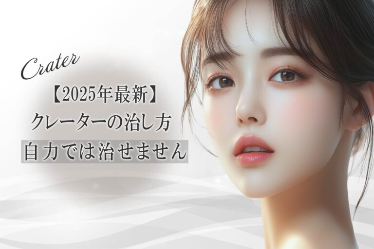 【2025年最新】クレーターの治し方【自力では治せません】