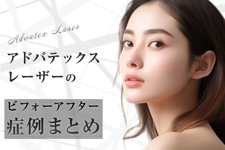 アドバテックスレーザーのビフォーアフター症例まとめ