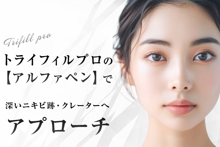 トライフィルプロの「アルファペン」で深いニキビ跡・クレーターへアプローチ