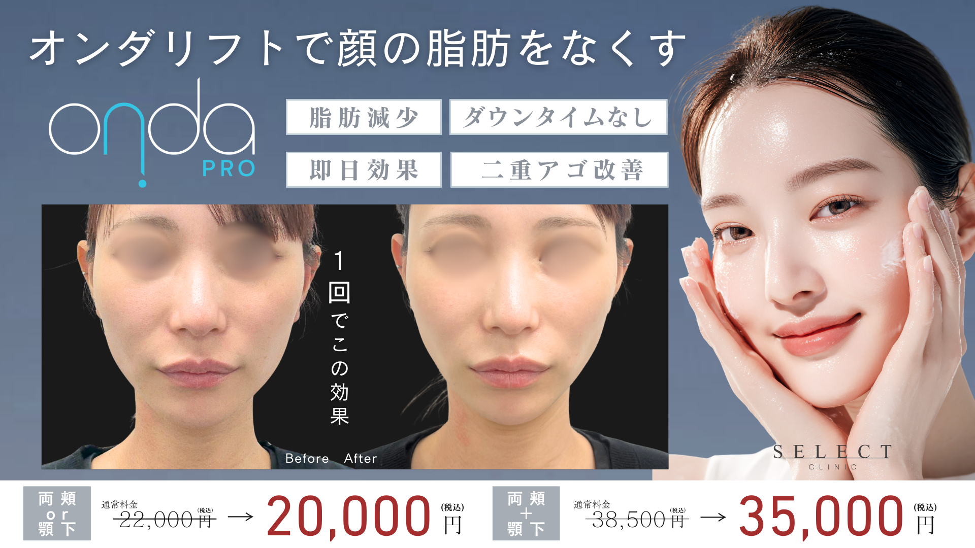 オンダリフト オンダプロ 症例 ビフォーアフター 体験談