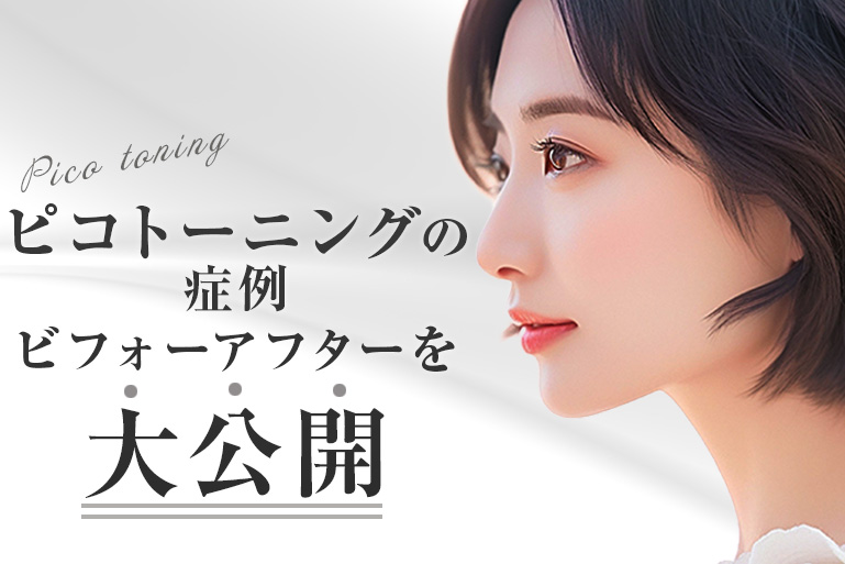 ピコトーニングの症例ビフォーアフターを大公開